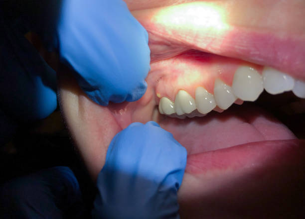 Best Mobile Emergency Dentist in Germantown, IL