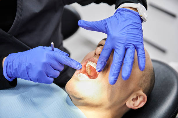Best Emergency Dentist for Knocked-Out Tooth in Germantown, IL